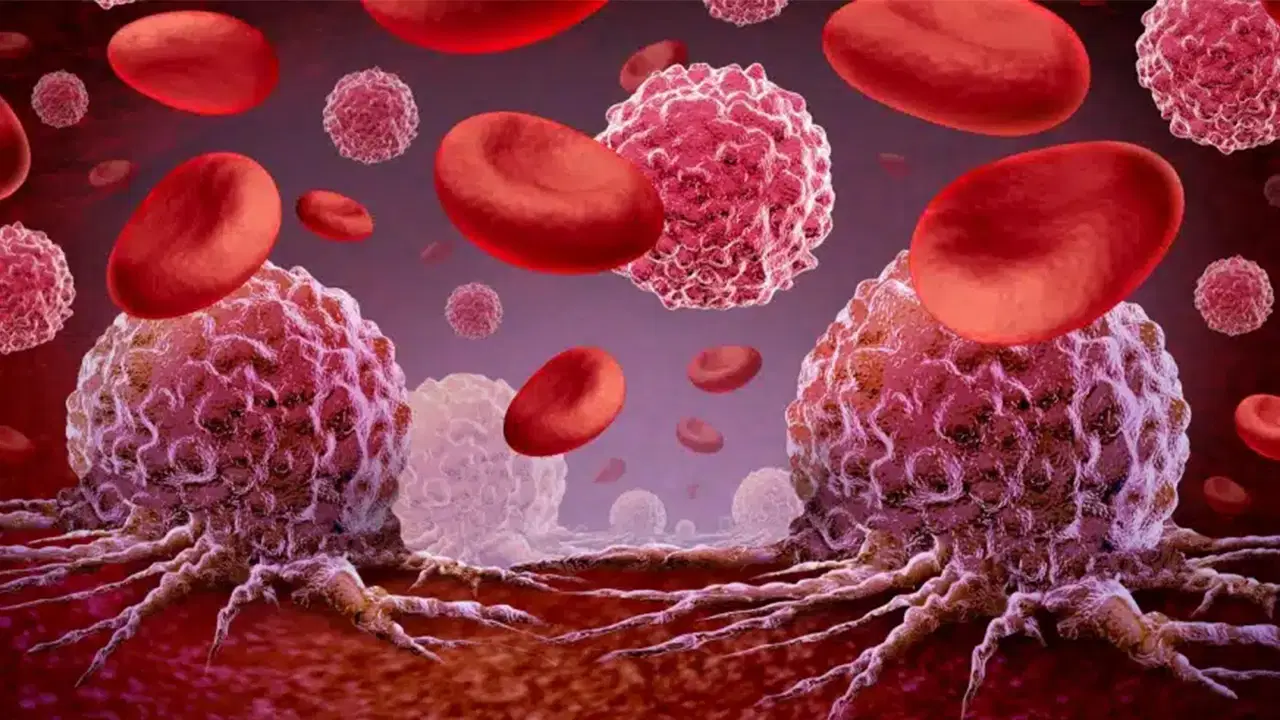 lenfoma erken teshisle buyuk oranda tedavi edilebiliyor HCJkZIVl